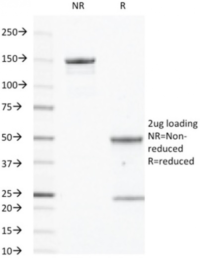 Data from SDS-PAGE analysis of Anti-EGFR antibody (Clone GFR450). Reducing lane (R) shows heavy and light chain fragments. NR lane shows intact antibody with expected MW of approximately 150 kDa. The data are consistent with a high purity, intact mAb.